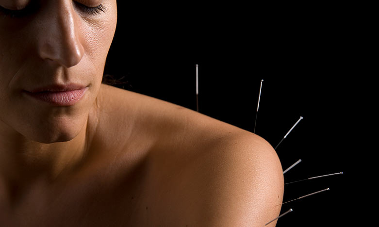 AcupunctureShoulderRegina